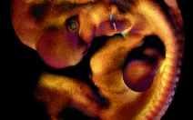 Embryopatie - obrázek